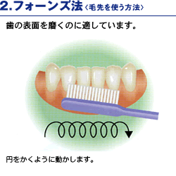 2.フォーンズ法